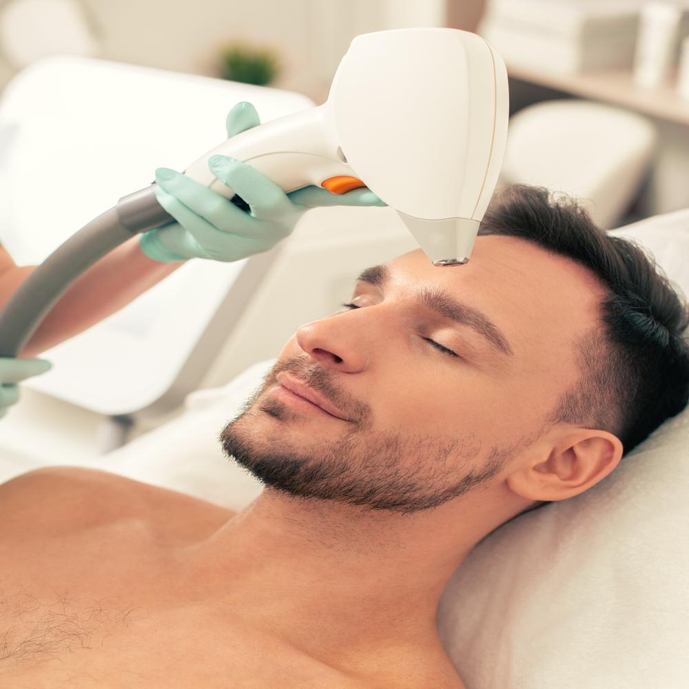 Laser Hair Removal – Men’s Forehead, Cheeks